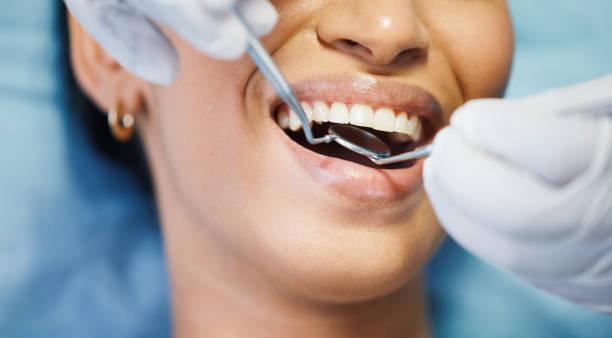Best Emergency Dental Services for Seniors in Sloan, IA